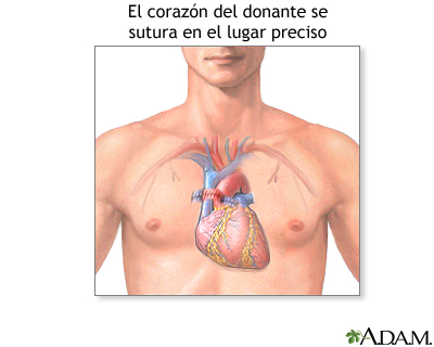 Cuidados postoperatorios