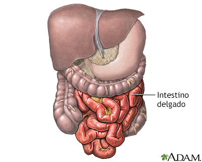 Divertículo de Meckel - anatomía normal