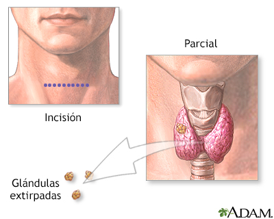 Procedimiento