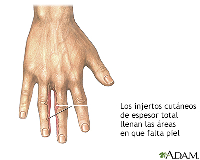 Procedimiento