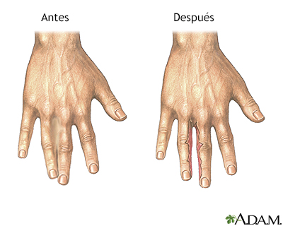 Cuidados postoperatorios