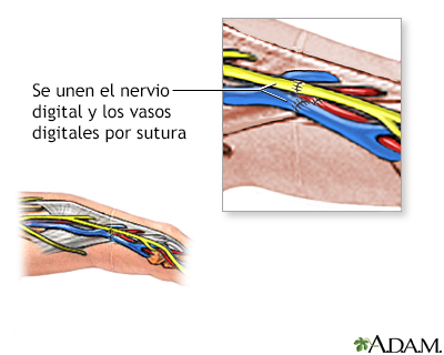 Procedimiento (segunda parte)