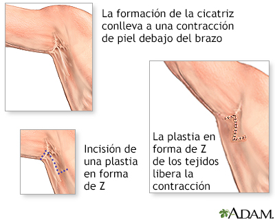 Procedimiento (primera parte)