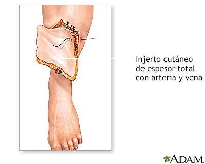 Procedimiento (segunda parte)