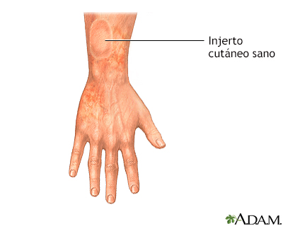 Cuidados postoperatorios