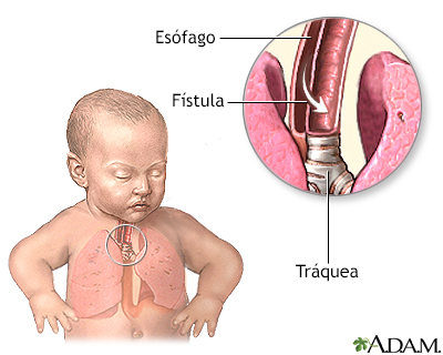 Indicaciones