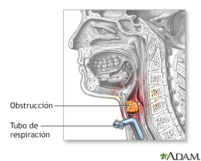 Procedimiento