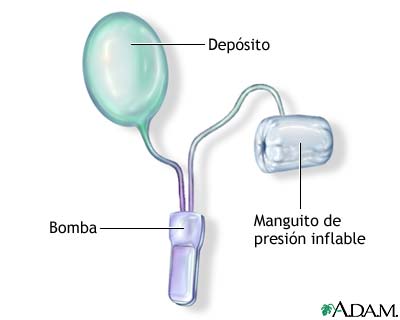 Procedimiento (primera parte)