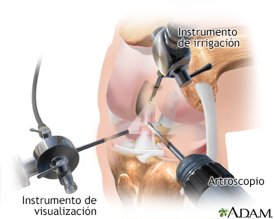 Procedimiento (primera parte)