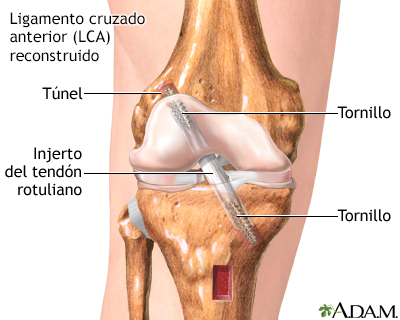 Cuidados postoperatorios