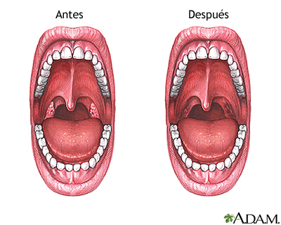 Cuidados postoperatorios