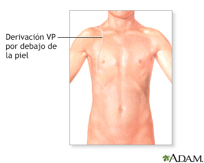 Cuidados postoperatorios