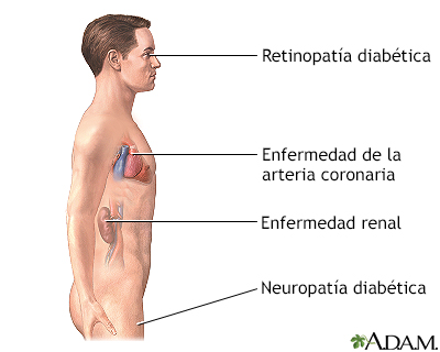 Indicaciones