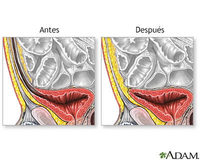 Cuidados postoperatorios