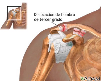 Indicaciones (segunda parte)