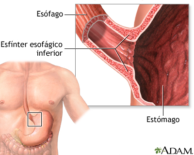 Acalasia - serie