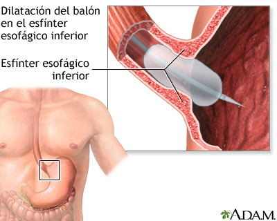 Procedimiento (primera parte)