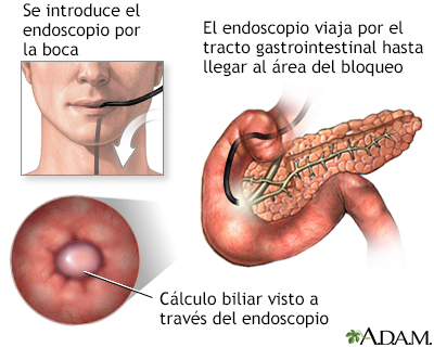 Procedimiento