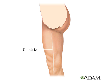 Cuidados postoperatorios