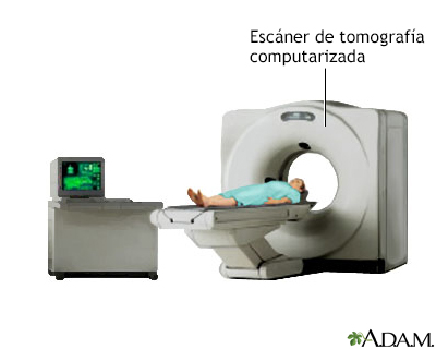 Procedimiento (segunda parte)