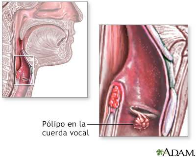 Indicaciones