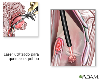 Procedimiento (segunda parte)