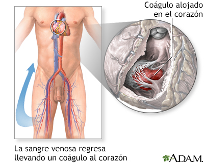 Procedimiento (primera parte)