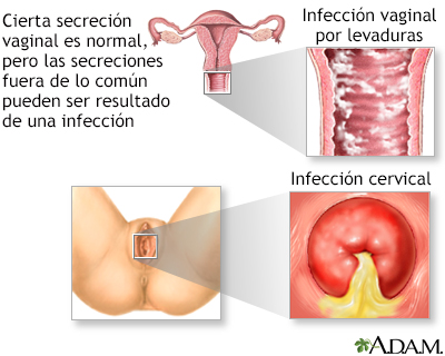 Secreción vaginal