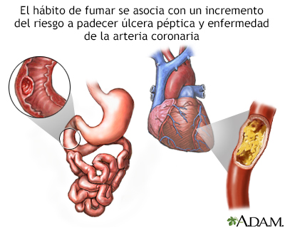 Tabaco y enfermedad vascular