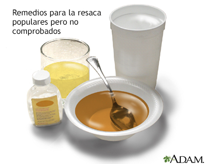 Remedios para la resaca