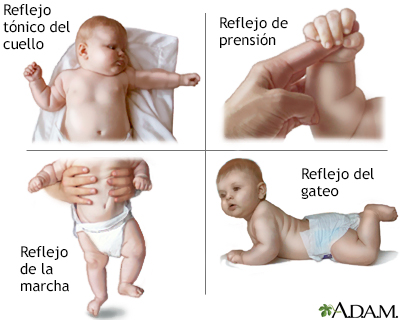 Reflejos infantiles