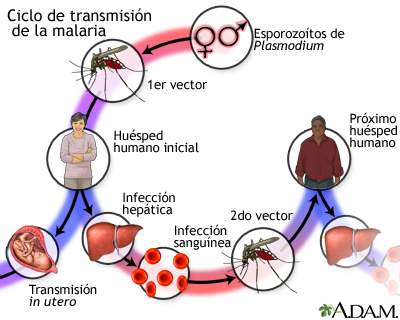 Malaria