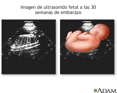 Ultrasonido a las 30 semanas