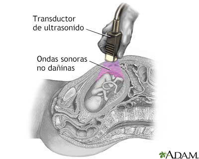 Ultrasonido