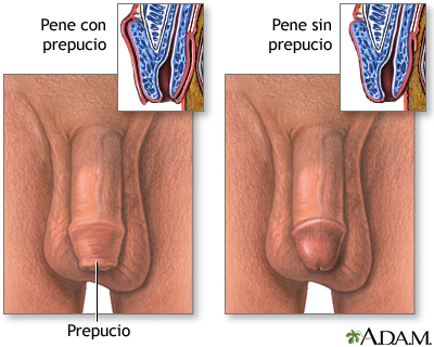 Pene - con y sin prepucio