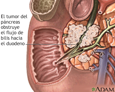 Indicaciones