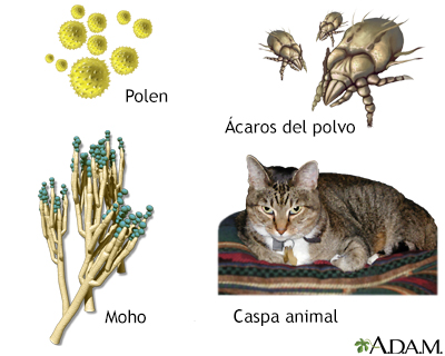 Factores desencadenantes comunes del asma