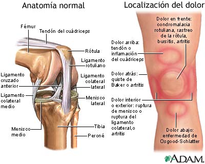 Dolor de rodilla