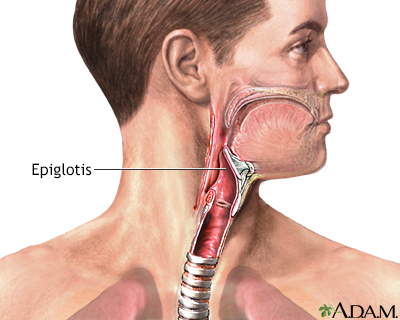 Epiglotis