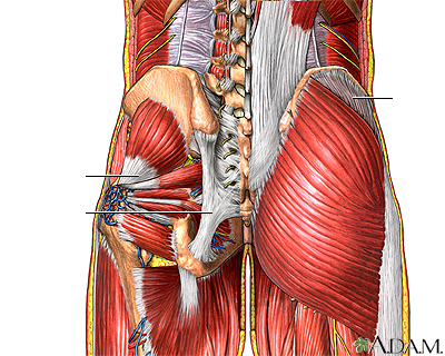 Dolor muscular