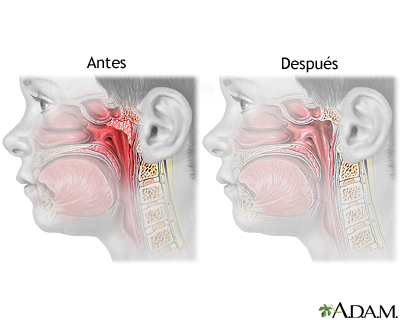 Cuidados postoperatorios