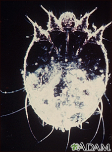 Microfotografía del ácaro de la escabiosis