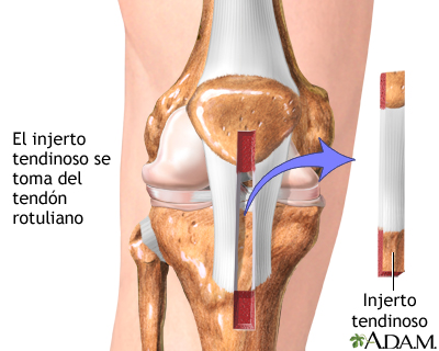 Procedimiento (primera parte)