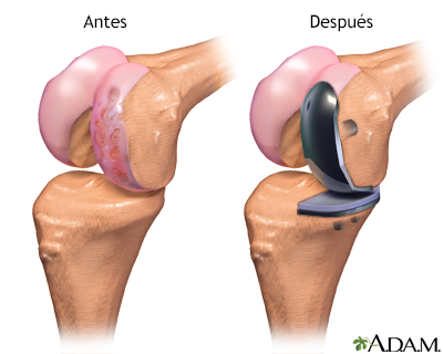 Cuidados postoperatorios