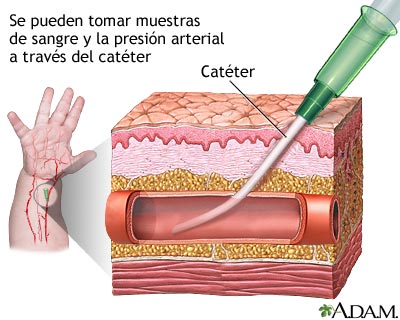 Vía arterial periférica