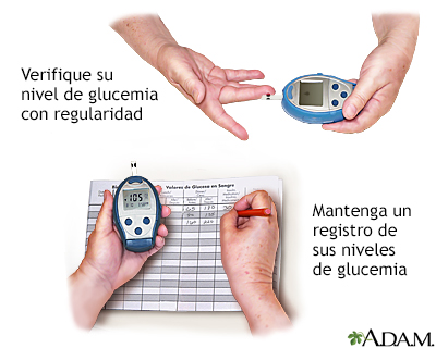 Maneje su glucemia