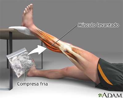 Tratamiento para distensión de la rodilla