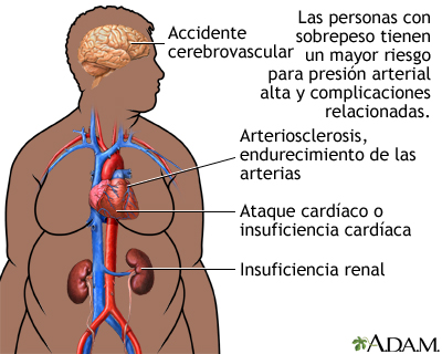 Obesidad y salud