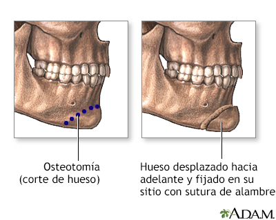 Procedimiento