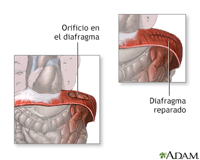 Procedimiento (segunda parte)